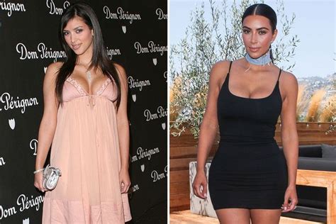 All The Plastic Surgery Kim Kardashian Has Rumoured To Have Had Done