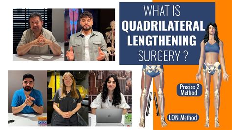 Limb Lengthening Specialists Explaining The Process Of Quadrilateral