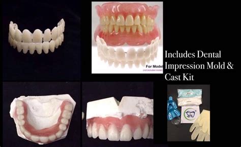 Do It Yourself Denture Kit False Teeth Plus Dental Impression Etsy In 2020 Dental