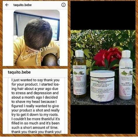 Introducing the hair growth castor oil. Formula D Hair ReGrowth Serum For CCCA | Etsy | Hair ...