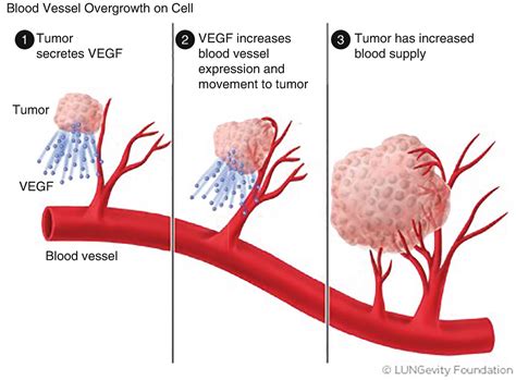 The Role Of Anti Angiogenic Agents Vegf Springerlink