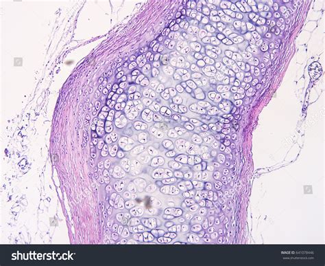 Histology Human Cartilage Connective Tissue Show Foto Stock 641078446