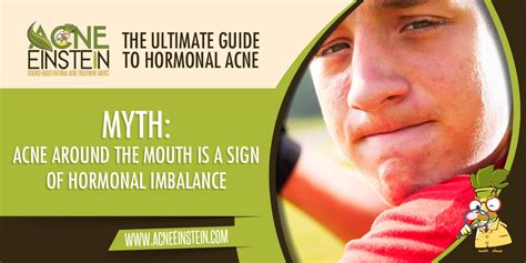 Myth Acne Around The Mouth Is A Sign Of Hormonal Imbalance The