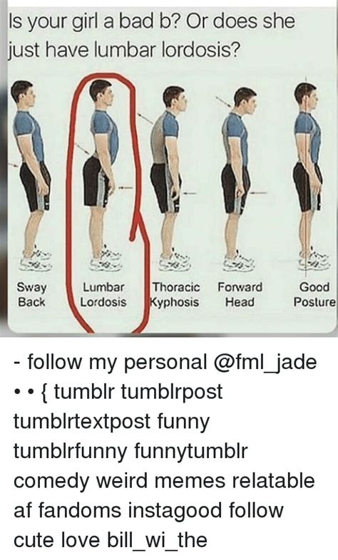 S Your Girl A Bad B Or Does She Just Have Lumbar Lordosis