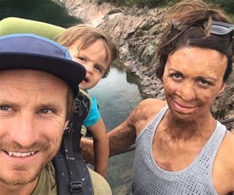 Turia Pitt And Michael Hoskin Love Story In Pictures