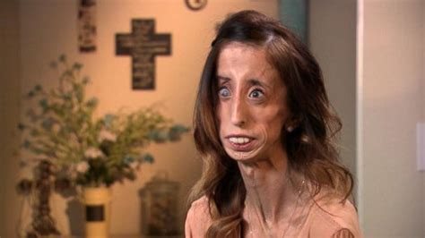 video lizzie velasquez on turning a life of bullying into powerful motivation abc news