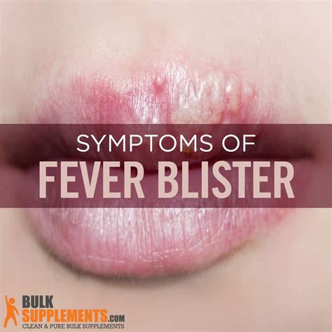 Fever Blisters Causes Symptoms And Treatments Bulksupplements