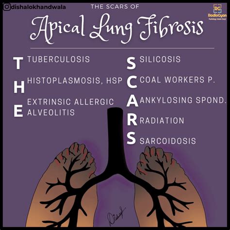 Causes Of Apical Lung Fibrosis Visual Mnemonics Radiogyan