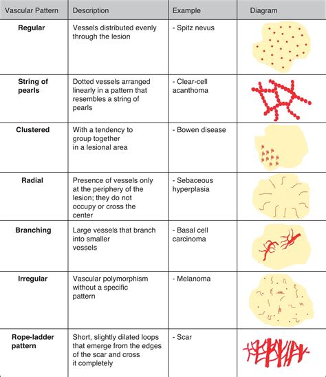 Table 7 From Classification Of Dermoscopy Skin Lesion Color Images Images