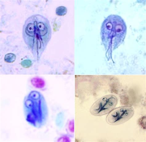 ASM On Twitter On The Th Day Of Microbes ASM Press Showed Me Giardia Duodenalis It S A