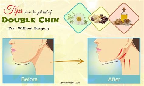 31 Tips How To Get Rid Of Double Chin Fast Without Surgery