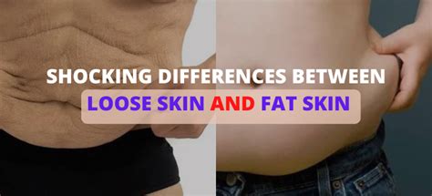 Differences Between Loose Skin Vs Fat