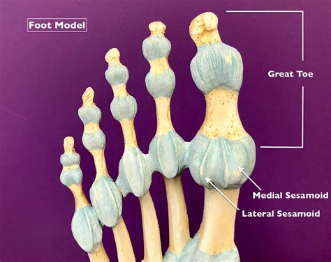 Could Your Nagging Foot Pain Be Sesamoiditis