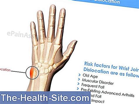Wrist Pain Causes And Treatment 💊 Scientific Practical Medical Journal