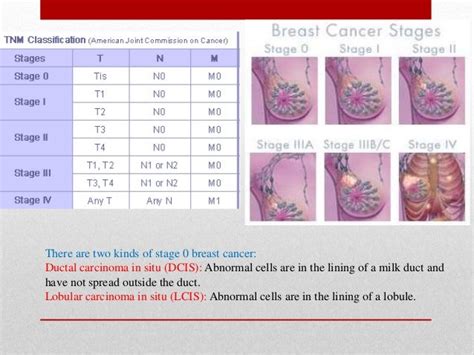 The Breast Cancer And Its Different Type Stages And Grading The T
