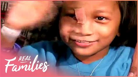 Girl With Face Deformity Sees Transformationlittle Miracles S2 E8 Real Families Youtube