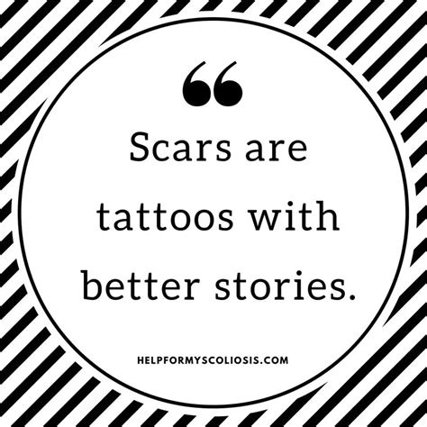 5 Reasons To Love Your Scars Living With Scoliosis