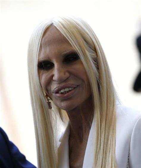 Donatella Versace Before After I Danni Della Chirurgia Estetica