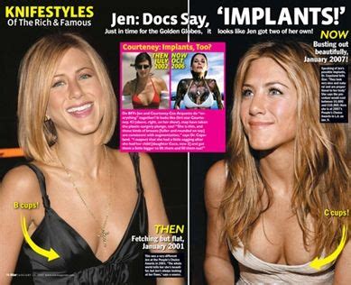 Jennifer Aniston Plastic Surgery Breast Implants Before And After Nose
