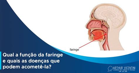 Qual A Função Da Faringe E Quais As Doenças Que Podem Acometê La Dr