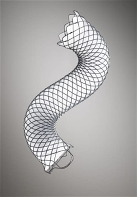 WallFlex Biliary RX Fully Covered Stent Study Enrols First Patient