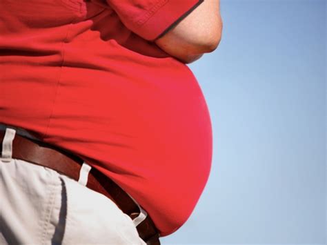 Americas Obesity Epidemic See Where New York Ranks Larchmont Ny Patch