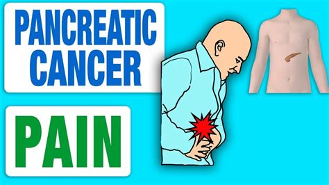 Pancreatic Cancer Pain Youtube