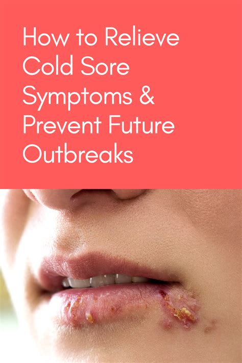 How To Prevent Cold Sores Cold Sores Video Stop The Spread Of