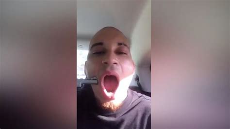 Wannabe Rapper Shoots Himself In The Face To Get Famous In Shocking