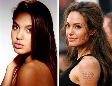 Angelina Jolie Before And After Plastic Surgery 11 Celebrity Plastic
