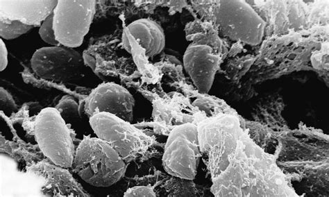 Siberia Bubonic Plague Fears Of Black Death Outbreak As Boy Fights For