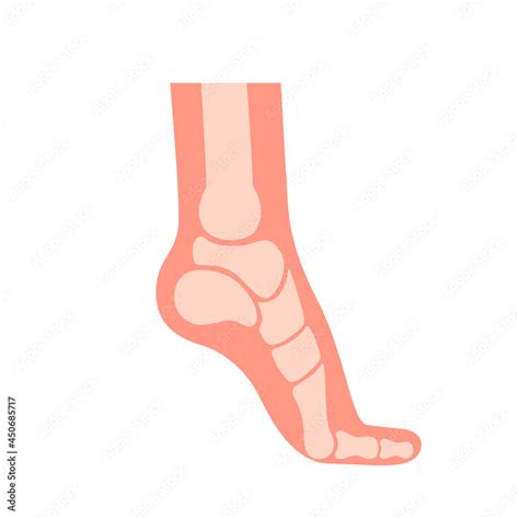 Silhouette Human Foot With Bones Orthopedic Leg Healthy Feet Foot Deformation Defect