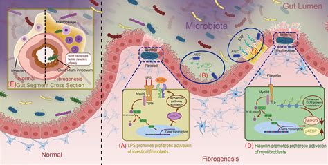 Frontiers Intestinal Fibrosis And Gut Microbiota Clues From Other Organs