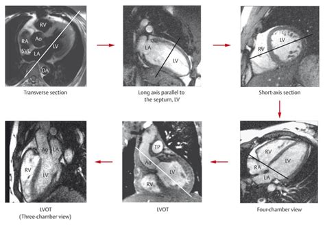 5 Cardiac Magnetic Resonance Imaging And Computed Tomography Thoracic Key
