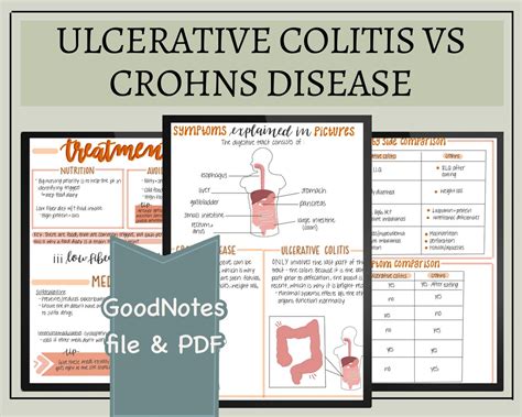 Ulcerative Colitis Vs Crohns Disease Nursing Notes Digital Etsy Uk