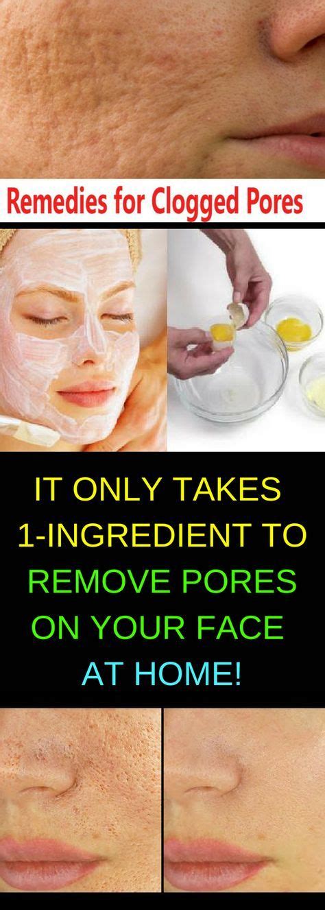 It Only Takes 1 Ingredient To Remove Pores On Your Face At Home Health
