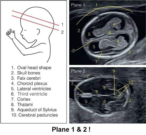 Baby Head Medical Ultrasound Ultrasound Sonography Ultrasound