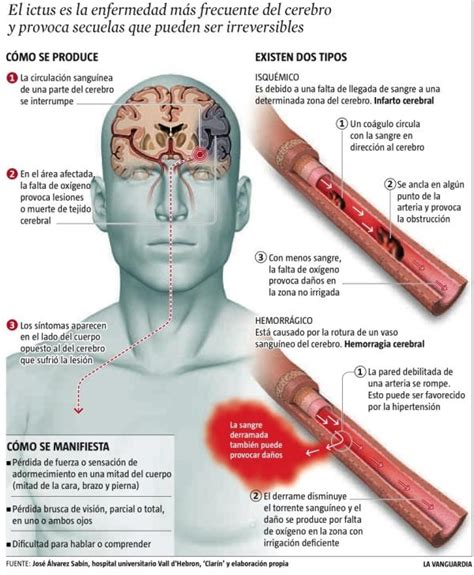 The brain can thus be described as being divided into left and right cerebral hemispheres. Fisioterapia y Rehabilitación de: ACCIDENTE ...