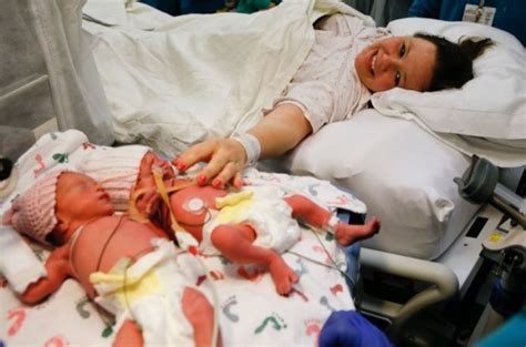 mother s day special rare mono mono twins born holding hands in ohio [photos video] ibtimes