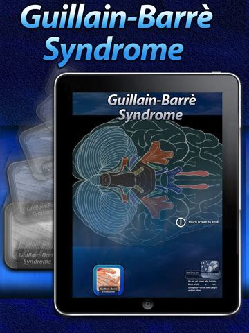 If the condition is severe, a patient is at risk for complications like pulmonary embolism and heart failure. Guillain - BarrE Syndrome App for iPad - iPhone - Medical