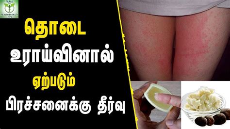 Natural Remedies For Inner Thigh Rashes Skin Care Tips In Tamil