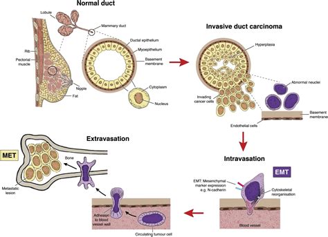 The Significance Of Circulating Tumour Cells In Breast Cancer A Review