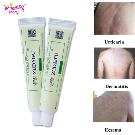 ifory zudaifu skin psoriasis cream 2pcs dermatitis eczematoid eczema ointment allergic