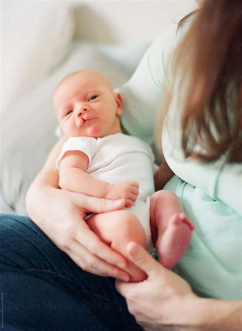 Newborn Baby With A Cleft Lip Being Held By His Mother Del Colaborador De Stocksy Marta