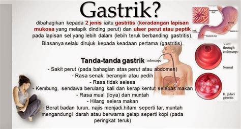 Apakah tanda gastrik ▼ ▲. Sihat Itu Nikmat - HEALTH | BISNES | FAMILY: Gastrik ...