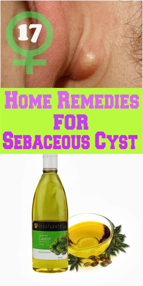 home remedies store 17 home remedies for sebaceous cyst natural health tips home remedies