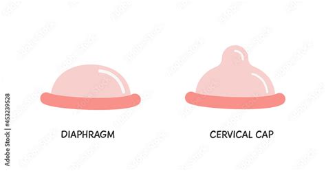 Contraceptive Diaphragm And Cervical Cap Colored Flat Style Icons Birth Control Methods Safe