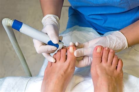 Professional Chester Podiatrists Chester Chiropody