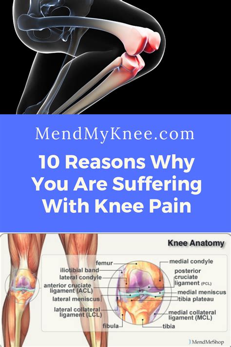 Pin On Knee Pain And Inflammation Relief