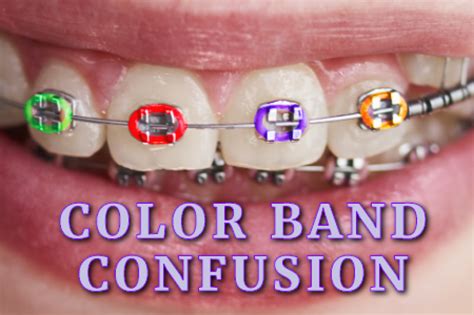 Tips For Colored Braces Chamblee Orthodontics Atlanta Ga